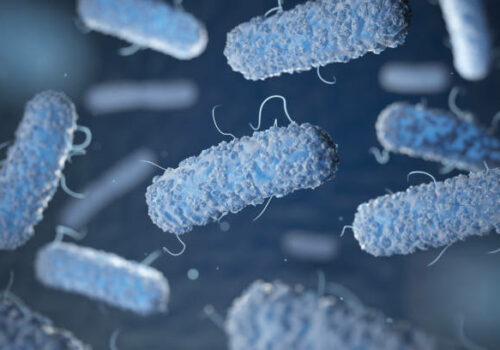 Trattamenti Antilegionella